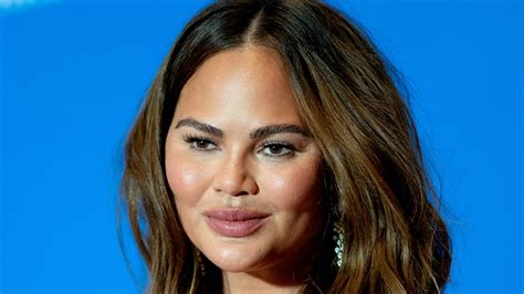 Chrissy Teigen Shared Photos Of Her C Section Scar After Being Accused