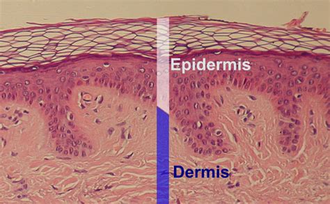 Epidermal Vs Dermal Pigmentation Just About Skin