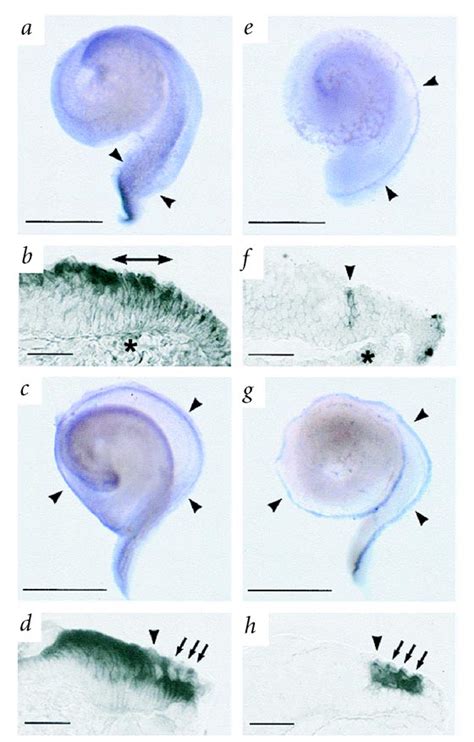Expression Of Notch1 And Jag2 In The Developing Mouse Cochlea At E145