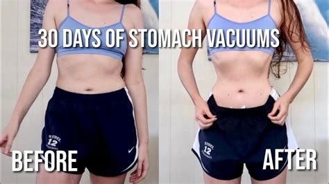 I Did Stomach Vacuums For 30 Days Before And After Youtube