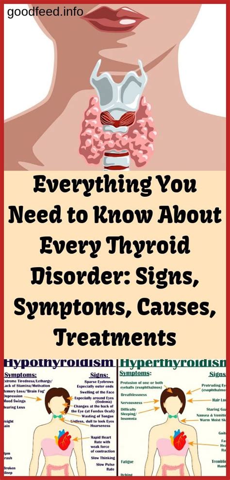 Here Is Everything You Should Know About Thyroid Disorders Signs