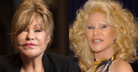 Jocelyn Wildenstein Before Surgery How Did She Look After Tv Show Stars