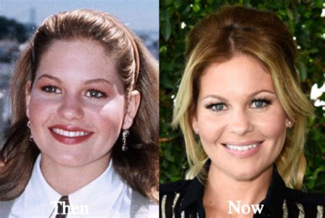 Candace Cameron Plastic Surgery Before And After Photos Latest