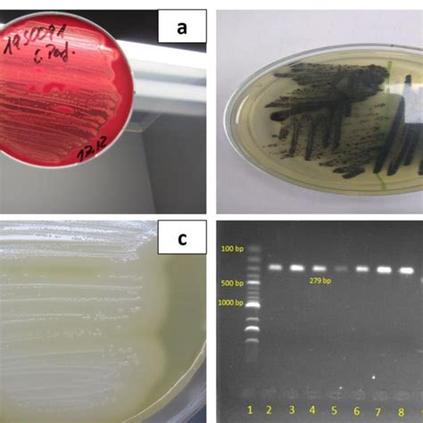 A Presence Of Double Zone Of Hemolysis Produced By C Perfringens On