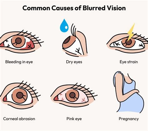 What Causes Blurred Vision Eyebuydirect Canada