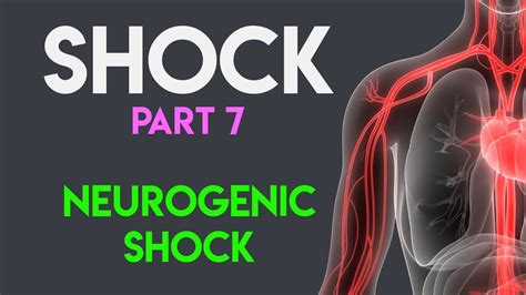So, in other words, shock (which is where cells are deprived of oxygen due to the lack of perfusion) occurs because of an invasion by a microorganism (septic). Neurogenic Shock | Shock (Part 7) - YouTube