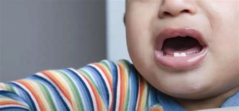 Do Babies Gums Bleed When They Teeth