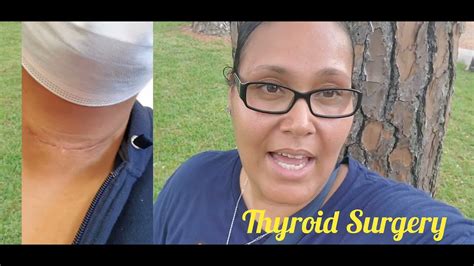 Thyroidectomy Scar Disappearing YouTube