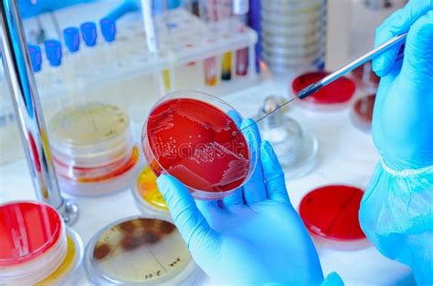 Petri Dish Microbiological Laboratory Stock Image Image Of Disease