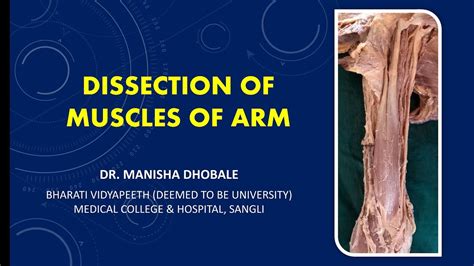 Dissection Of Arm Muscles Anatomy Attachments Nerve Supply Actions