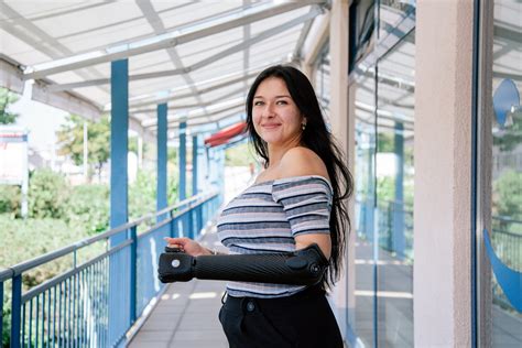 Worlds First 3d Printed Bionic Arm Is Now Available To Amputees Across Germany 🇩🇪 Open Bionics