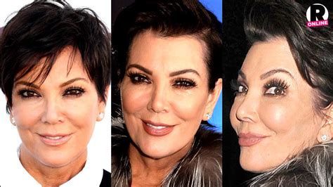 Plastic Fantastic Surgeon Claims Kris Jenner Used Botox Injections To Get A New Face Click