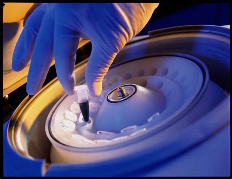 What Centrifugation Is And Why Its Used