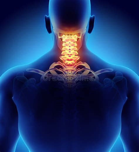 3d Illustration Of Cervical Spine Medical Concept Stock Illustration