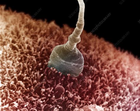 Human Spermatozoa Fertilizing An Egg Stock Image P