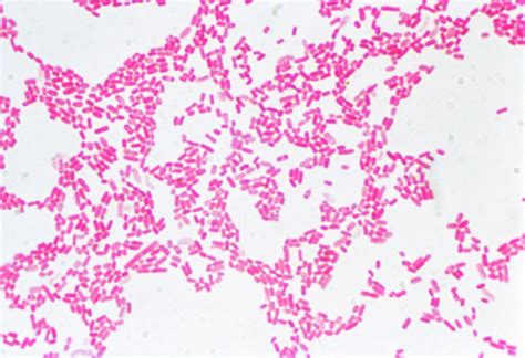 Lm Of The Gram Negative Bacteria E Coli Photograph By Drrosalind King