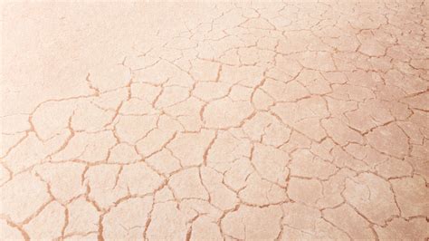 Dry Skin Explained Causes Symptoms And Treatments