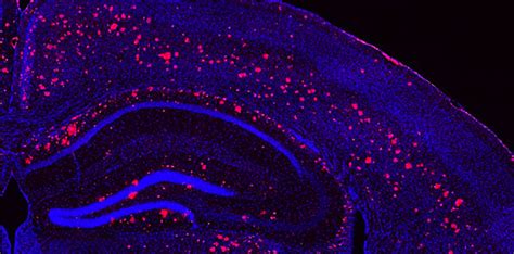 Brain Cells Under Microscope Micropedia