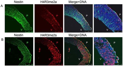 H4r3me2s But Not H4r3me2a Are Found In The Early Neural Precursors At