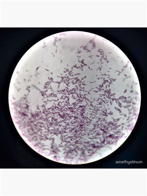Bacillus Cereus Endospore Stain 2 Sticker For Sale By Amethystinum