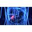 Gallbladder Troubles  HealthScope