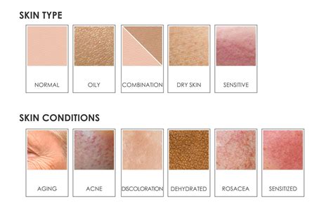 Skin Types And Conditions Leaderma