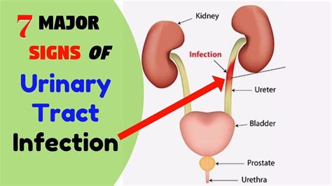 7 Major Symptoms Of Urinary Tract Infection Urinary Tract Infection