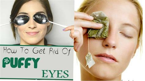 Easy Home Remedies To Cure Puffy And Swollen Eyes Youtube