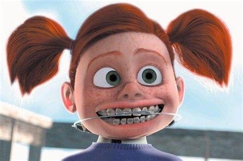 18 Faces Everyone Whose Had Braces Will Immediately Recognize Braces