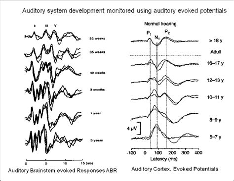 Auditory System Maturation As Revealed By Auditory Evoked Potential