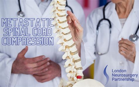 Metastatic Spinal Cord Compression London Neurosurgery Partnership