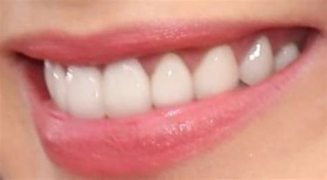 Emily Blunt Teeth Pictures