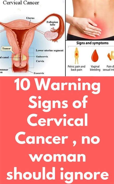 10 Warning Signs Of Cervical Cancer No Woman Should Ignore Hello Healthy