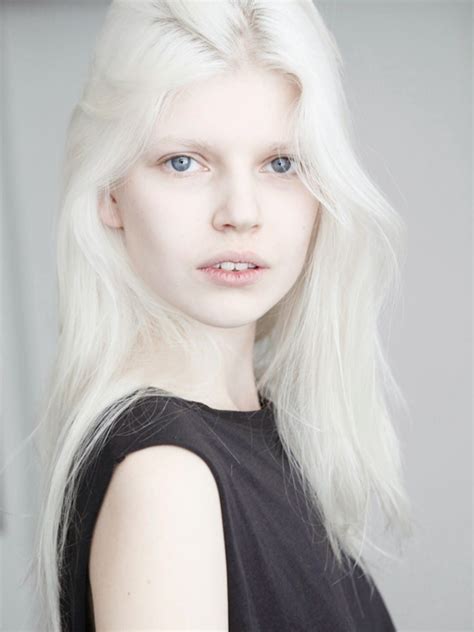 Pin On Albino Beauties