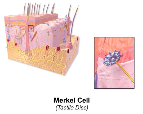 Stages Of Merkel Cell Carcinoma Sero