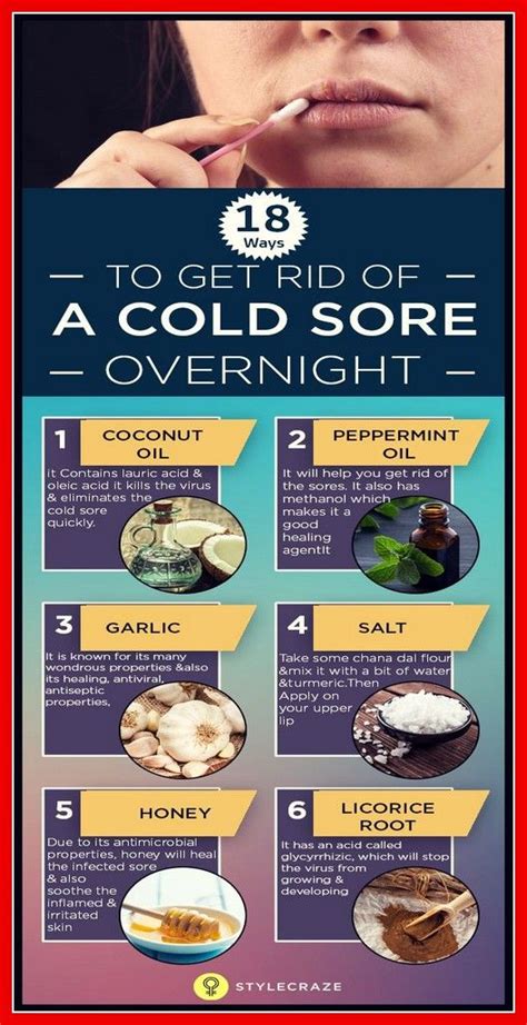 How To Get Rid Of A Cold Sore Overnight Without Medicine Cold Sore