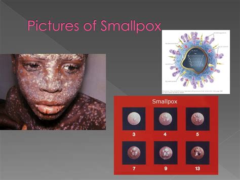 Ppt Smallpox Powerpoint Presentation Free Download Id1964414