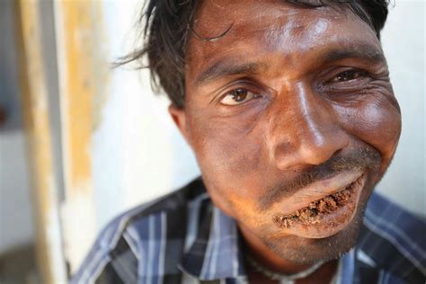 photos meet indian man addicted to eating mud bricks and rocks pakkirappa hunagundi