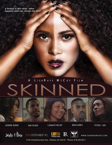 Watch The Powerful Trailer For The Movie Skinned The Source