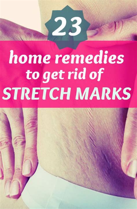 23 Effective Home Remedies To Get Rid Of Stretch Marks Stretch Marks