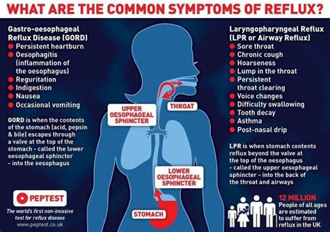 Reflux Reflux Symptoms Reflux Disease Nausea Heartburn Chronic