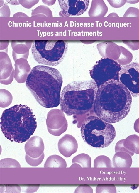 Pdf Chronic Lymphocytic Leukemia Cll