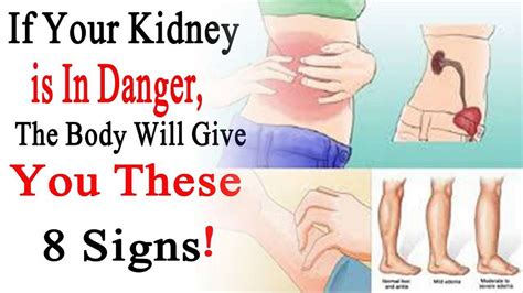 What Does Kidney Failure Pain Feel Like