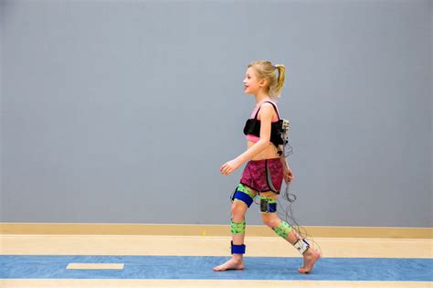 Improving Surgery Outcomes For Children With Cerebral Palsy