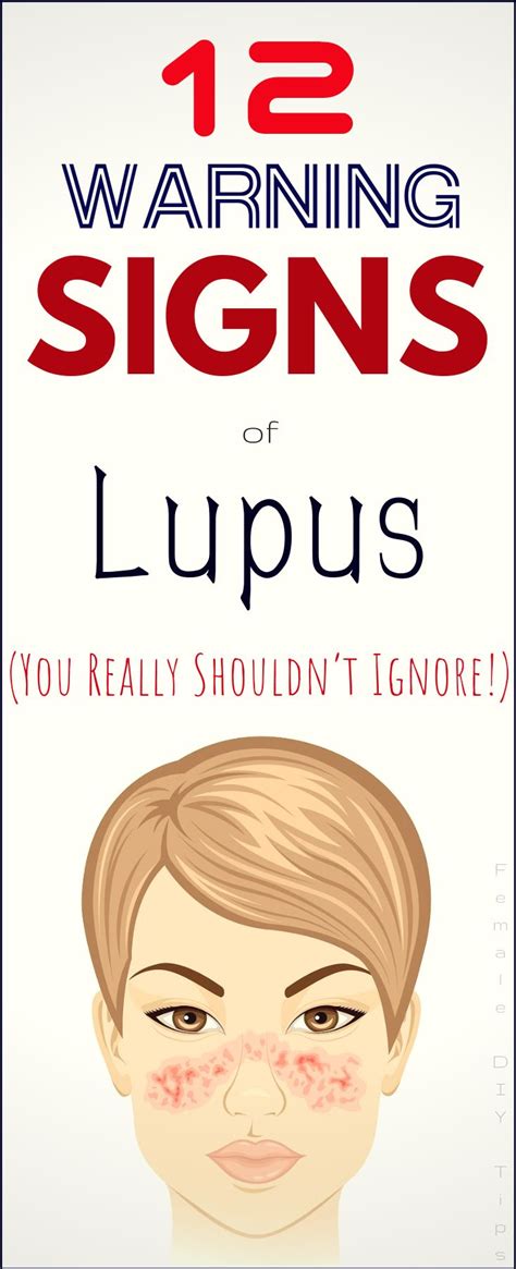 12 Early Warning Signs Of Lupus You Really Shouldnt Ignore How To