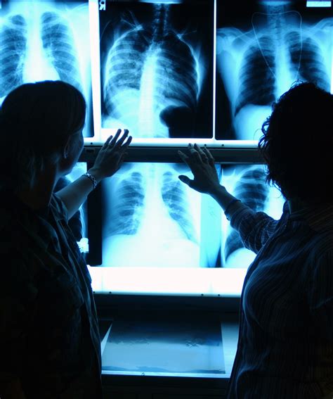 Who Is The Better Radiologist British Columbia Respiratory Therapy
