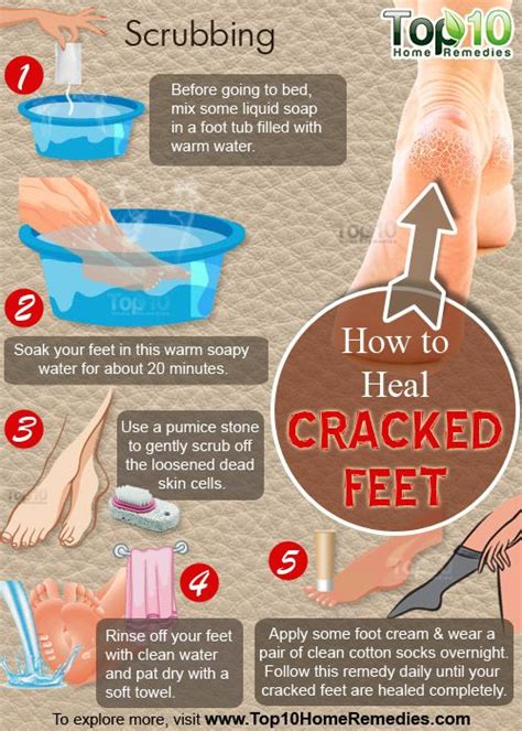 How To Heal Cracked Feet Healthier Planet Healthier Wallet Healthier Me Cracked Heel