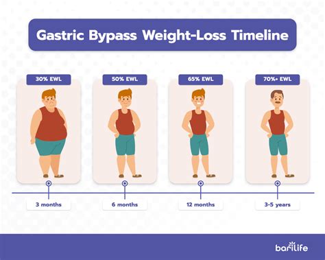 Gastric Bypass Weight Loss Chart