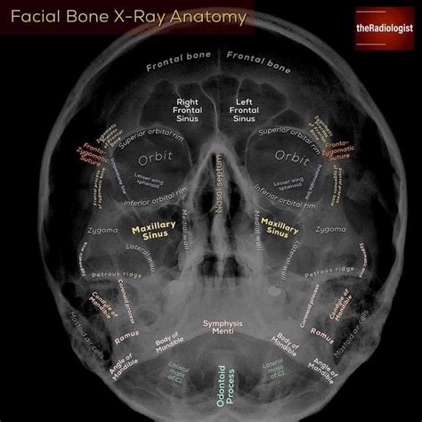 Radiology Schools Radiology Student Radiology Imaging Medical