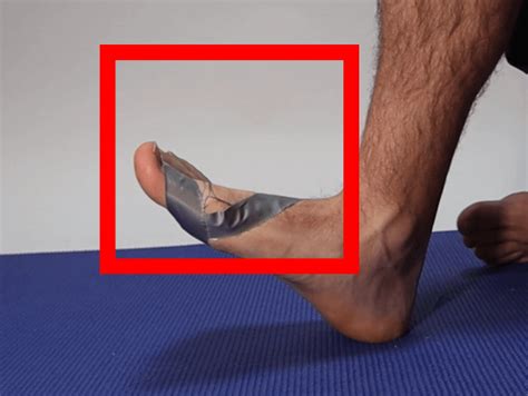 Best Big Toe Joint Sprain Treatment Turf Toe Home Treatment
